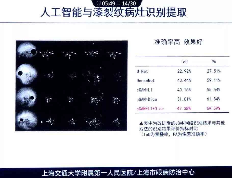 智能平安AI眼底成像深度分析报告