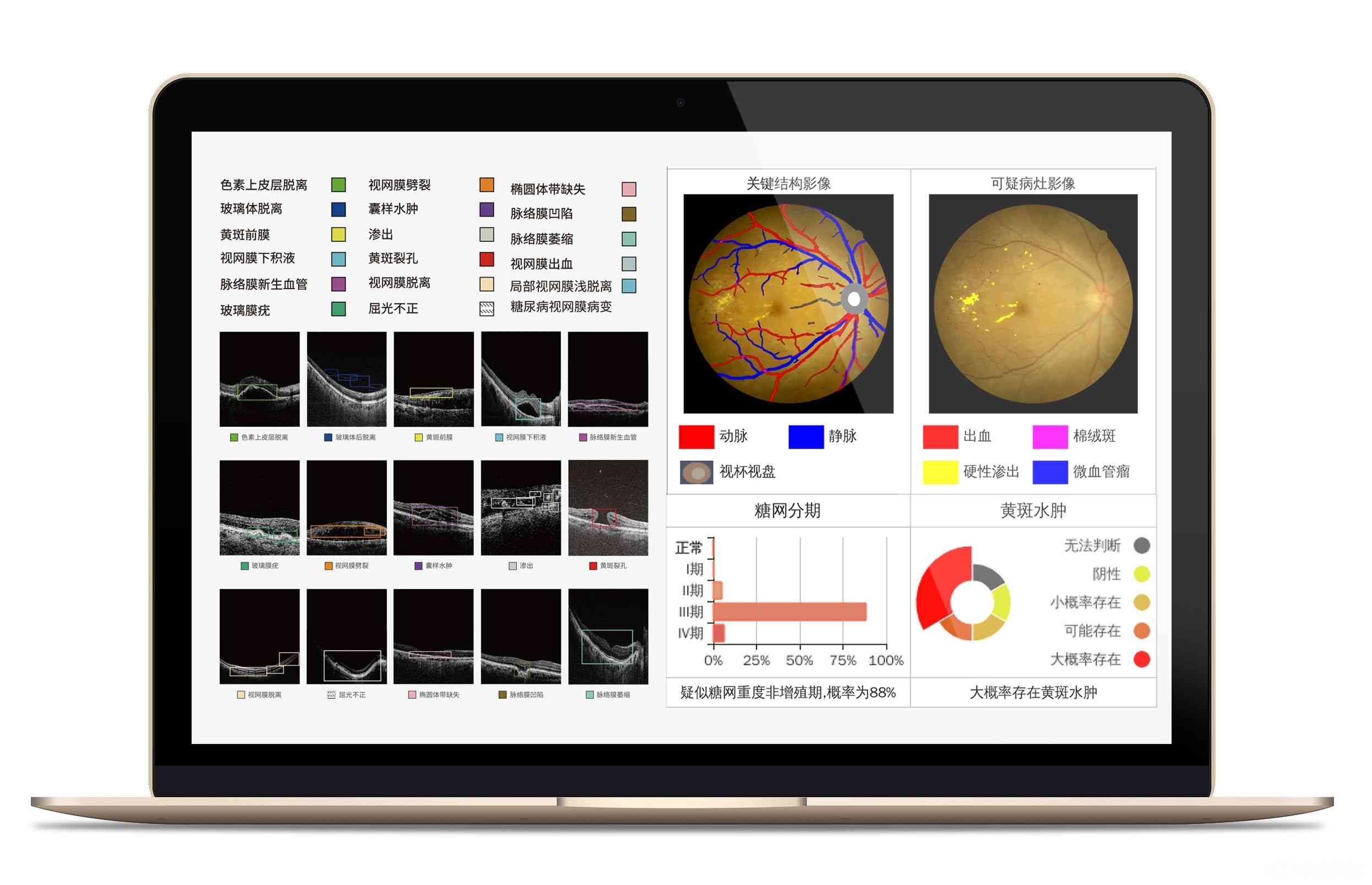 智能平安AI眼底成像深度分析报告