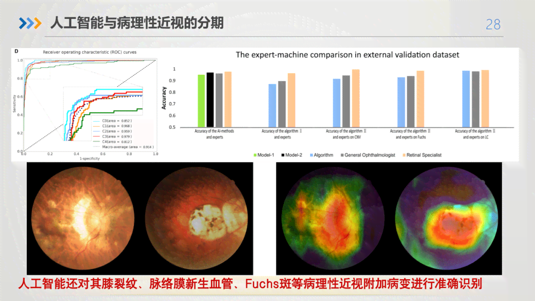 智能平安AI眼底成像深度分析报告