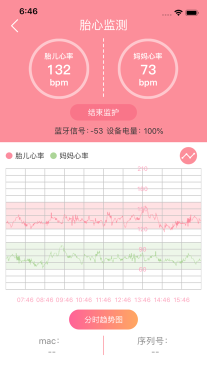 深入了解胎心监护ioco：孕期胎儿健监测新篇章