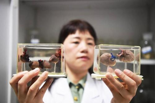 全面解读胎心监护仪数据：异常情况分析与孕期健管理指南