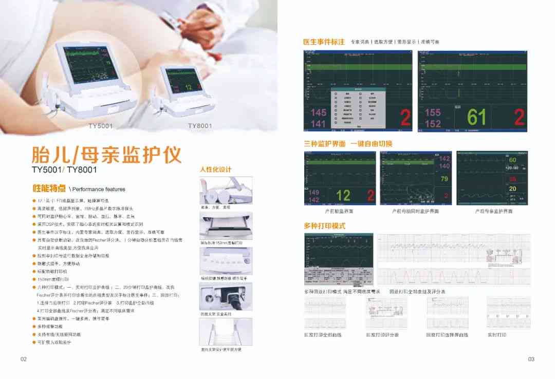 胎心监护仪ai报告是什么