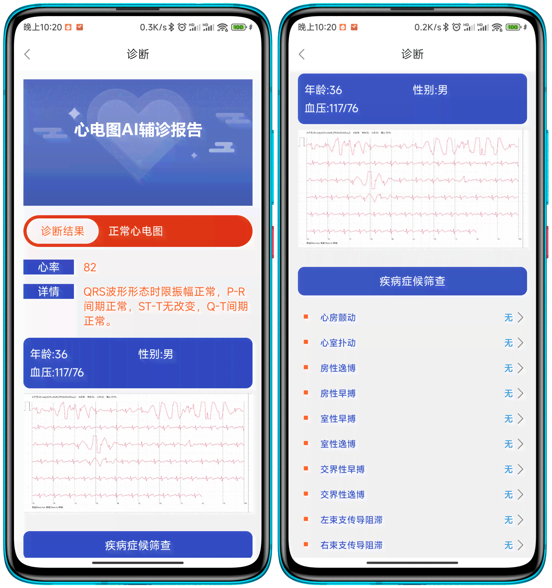 全方位解读：心电智能AI报告如何提升心电图诊断准确性与效率