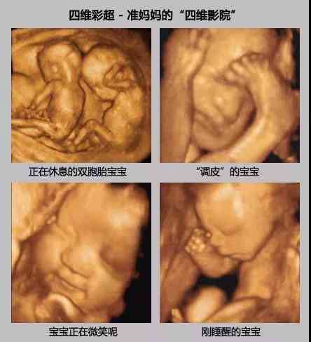 三维彩超显示婴儿脸部缺陷是否会影响出生后外貌及健状况