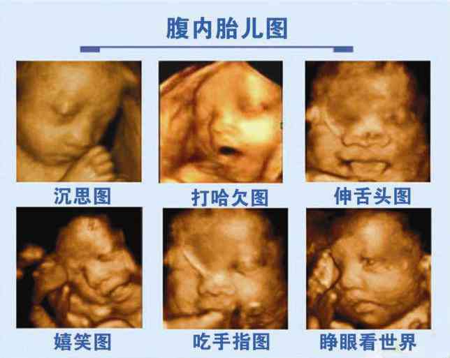 三维彩超ai生成脸文案