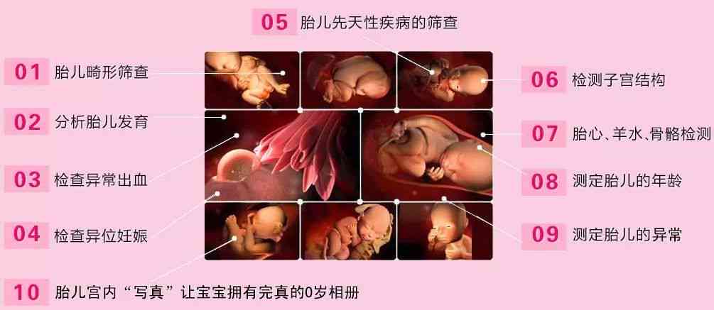 三维彩超ai生成脸文案