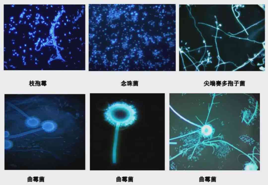 真菌荧光镜检操作流程：实与阳性结果含义解析