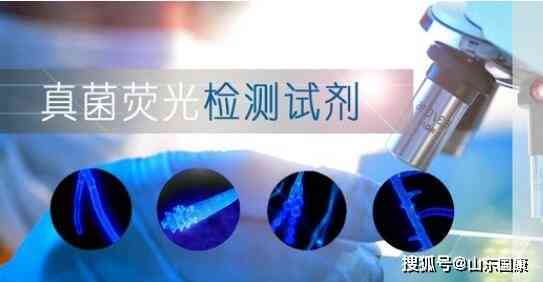 真菌荧光镜检操作流程：实与阳性结果含义解析