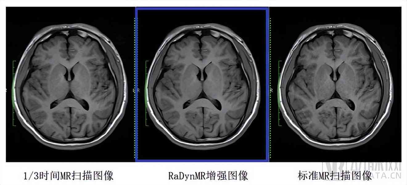人工智能技术在医学影像诊断领域的综合应用与未来发展趋势解析