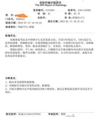 ai磁共振报告：解读与模板大全，包含报告单及检验报告样式