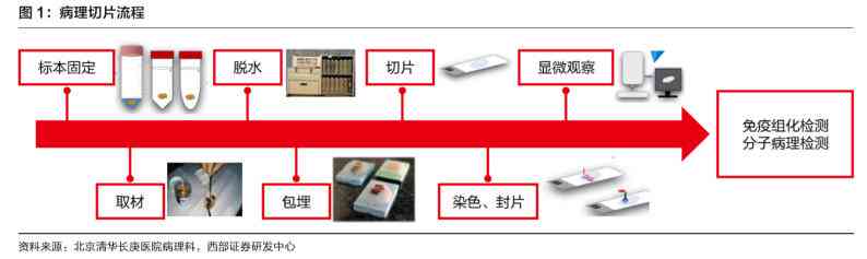解读检验报告ai