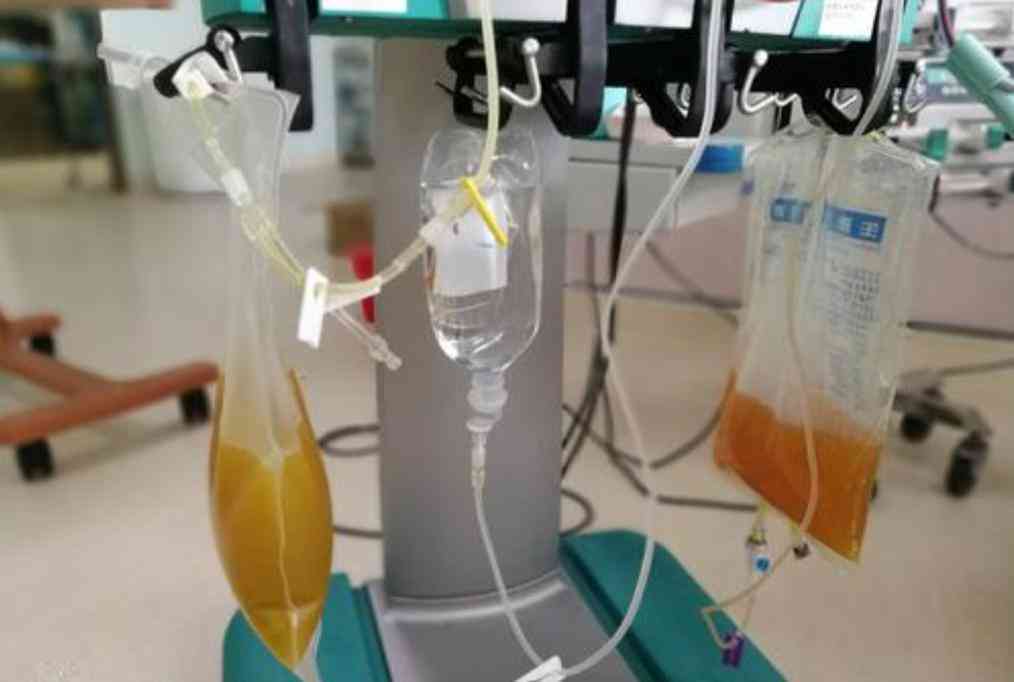 血型报告AI亚型鉴定准确吗_女性鉴定及费用解析