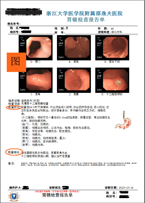 智能胃镜报告单分析系统AI
