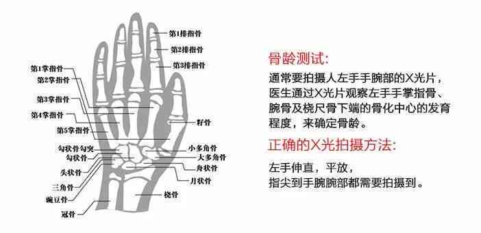 智能AI骨龄检测技术——精准评估儿生长发育与预测成年身高