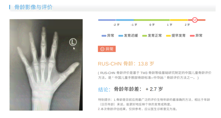 骨龄ai报告准不准