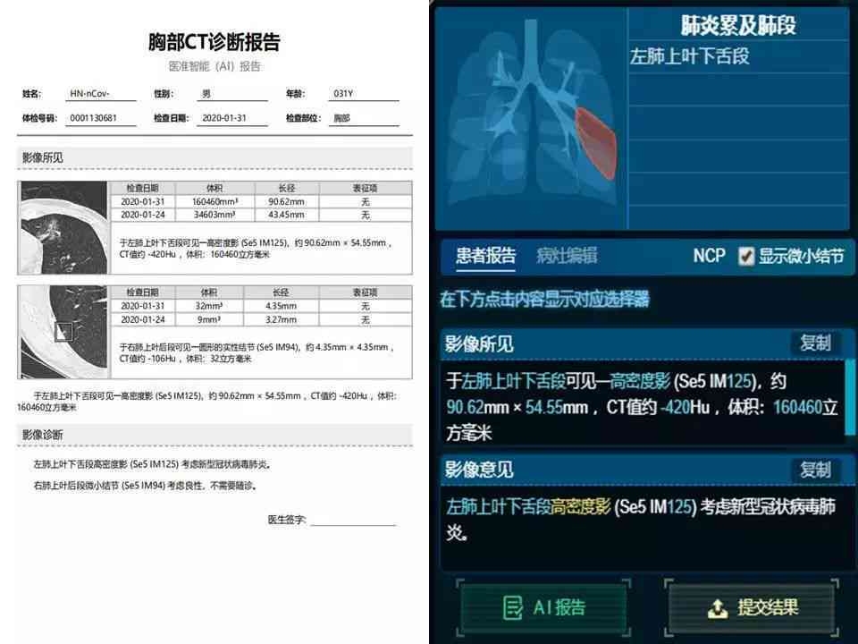 智能AI一键生成完整工作报告及解决方案：涵多场景应用与用户常见需求