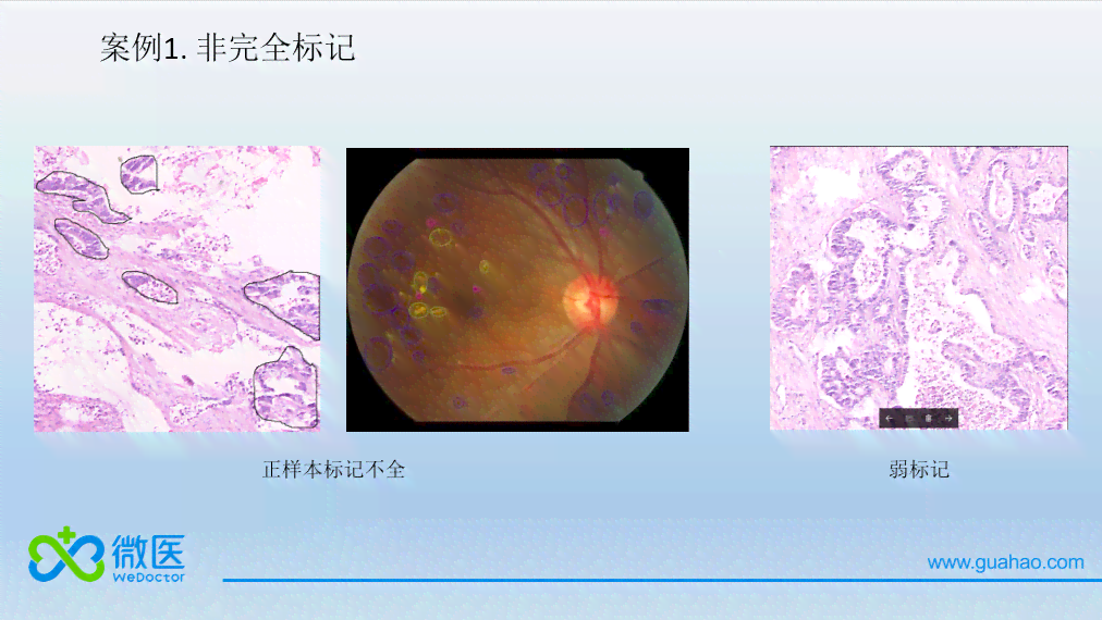 ai看磁共振报告怎么看的懂且清楚明白