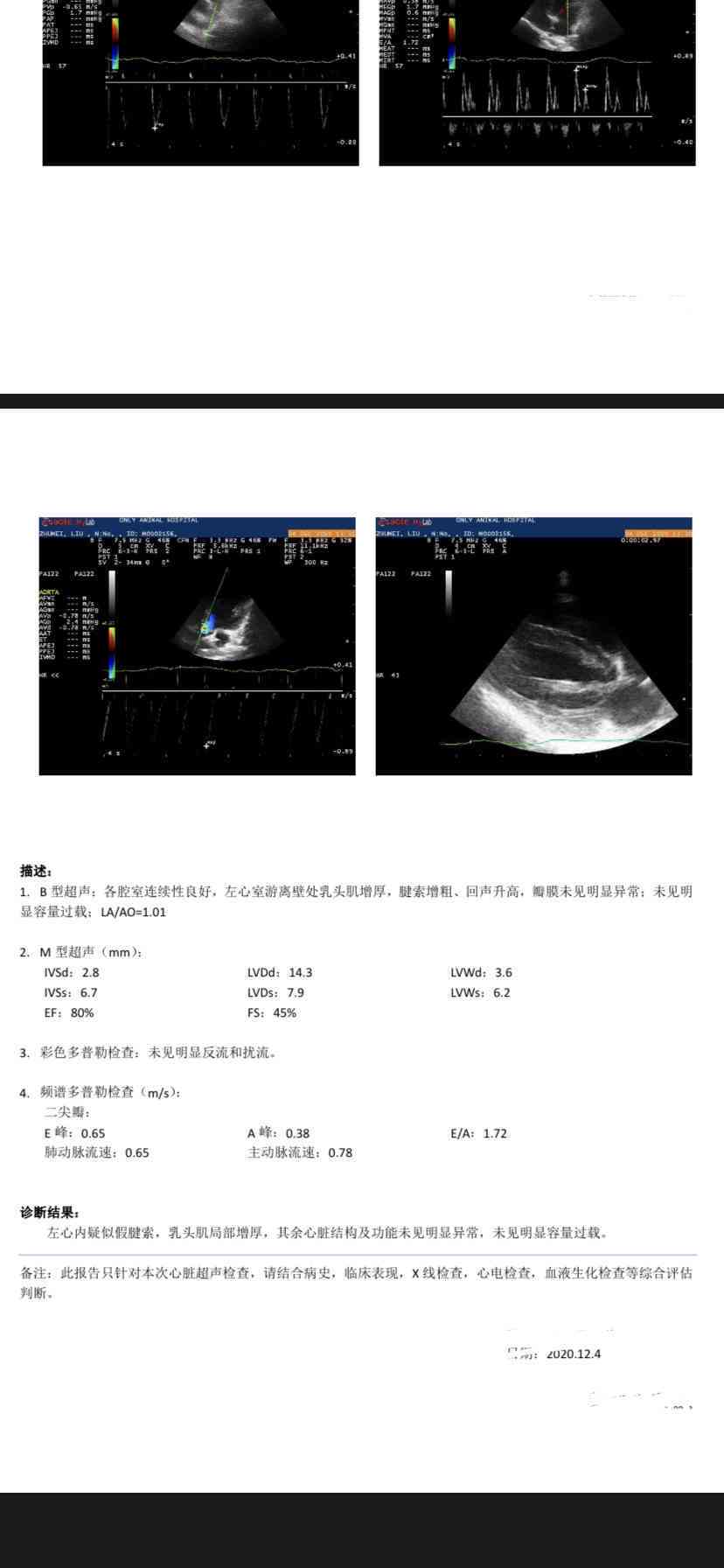 ai看磁共振报告怎么看的懂且清楚明白
