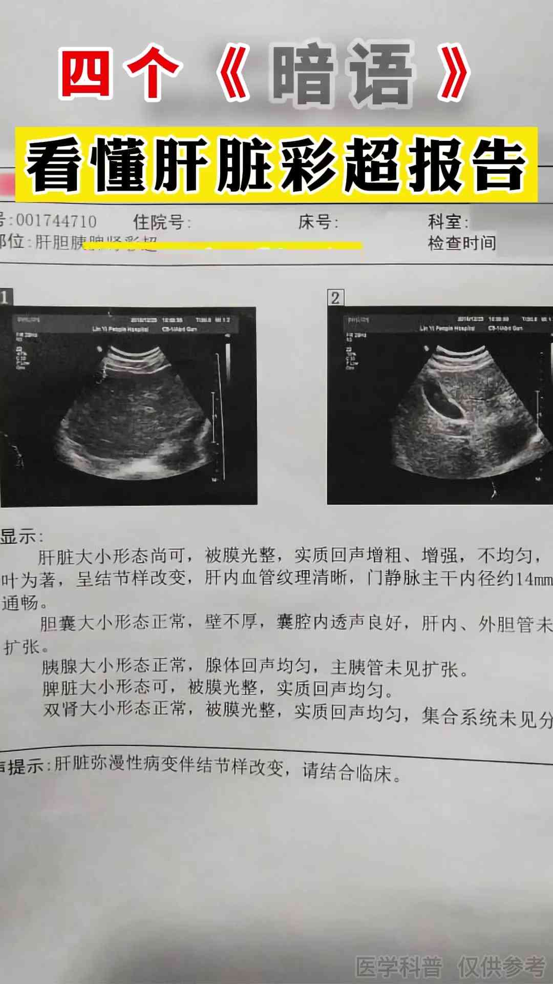 ai看磁共振报告怎么看的懂且清楚明白