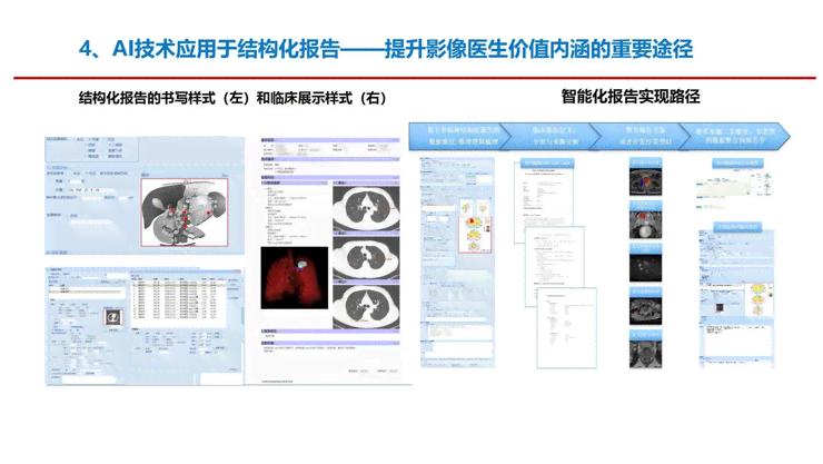 ai结构化报告