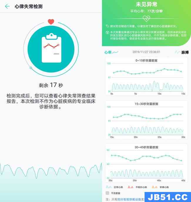 解读心电监测：AI智能报告深度解析