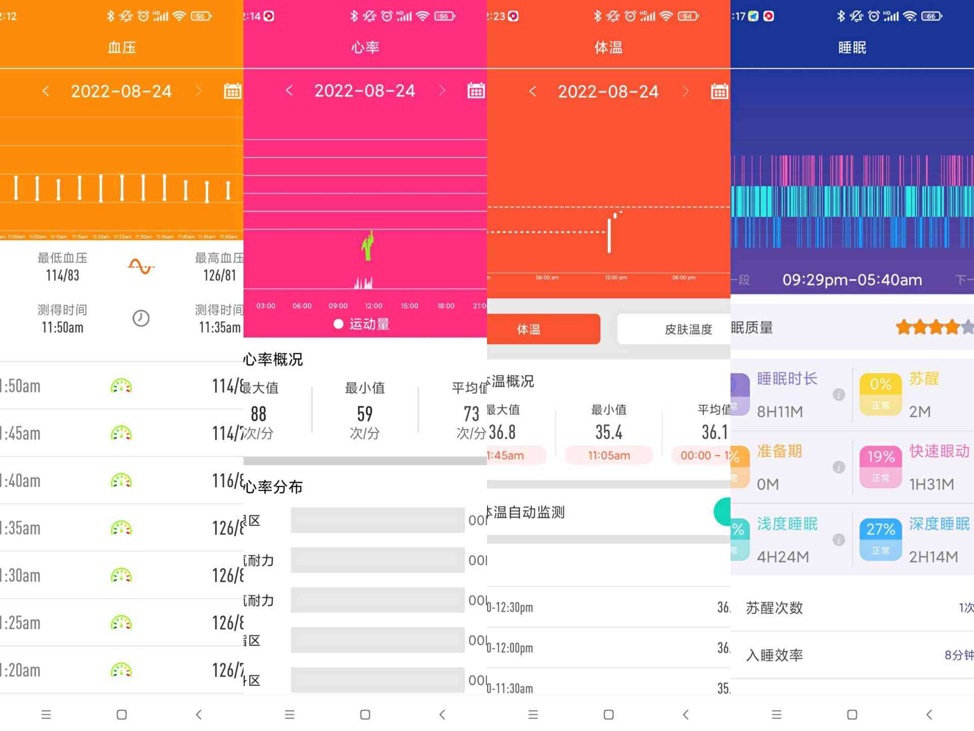 心电AI报告解读：全面解析心电图智能分析结果与常见疑问