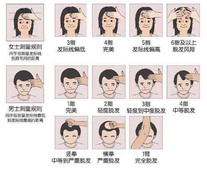 全方位解析脱发原因与解决方案：告别脱发困扰，找回秀发自信