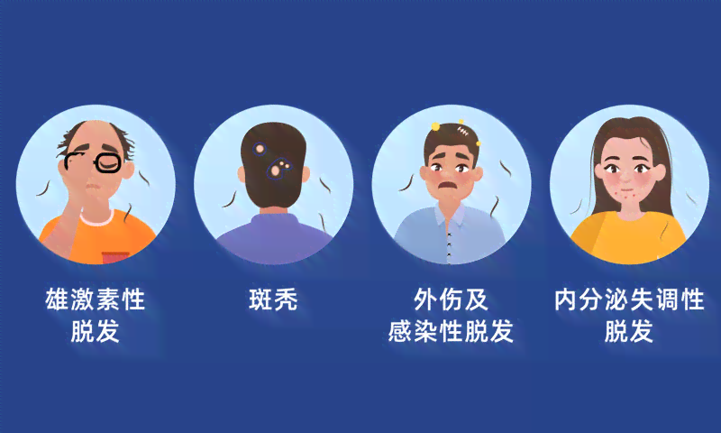 全方位解析脱发原因与解决方案：告别脱发困扰，找回秀发自信