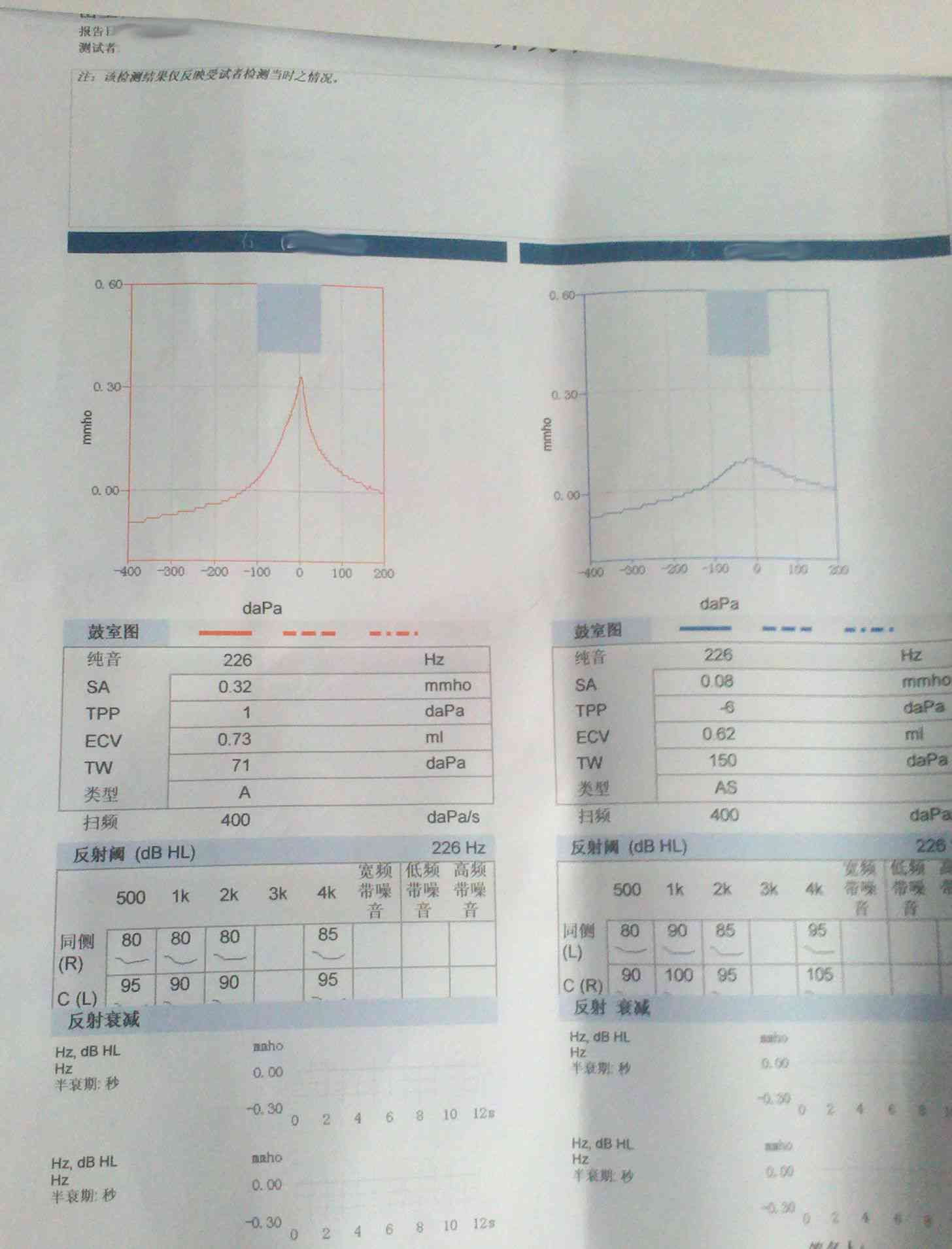 听力健评估报告NR：详尽分析及建议