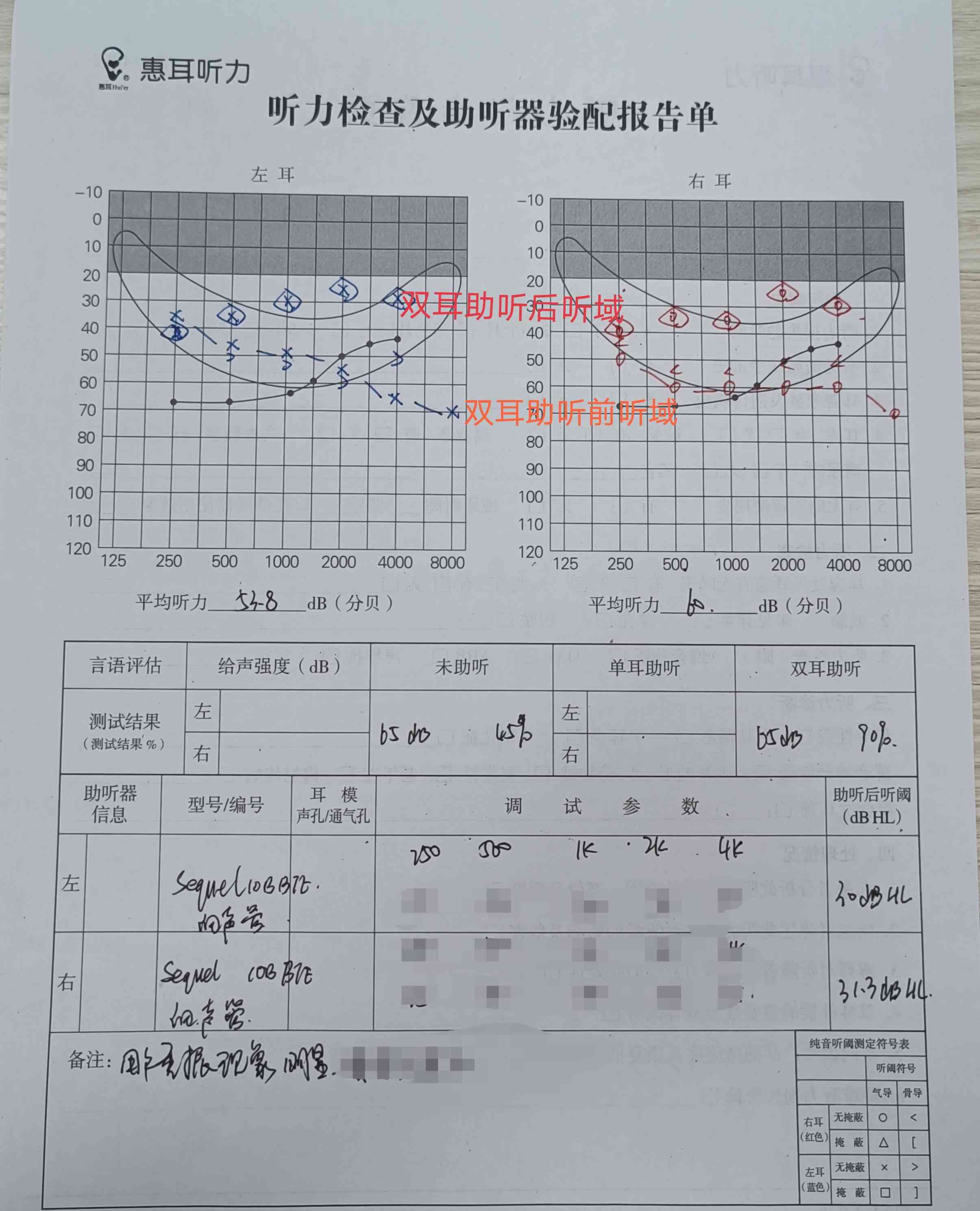 全面听力评估报告：解读听力检查结果与相关健建议