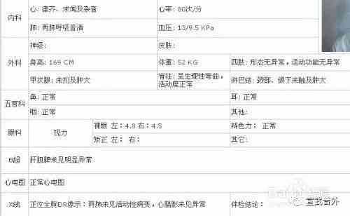 胎心监护仪ai报告是什么意思啊：解读胎心监护alarm含义与报告怎么看