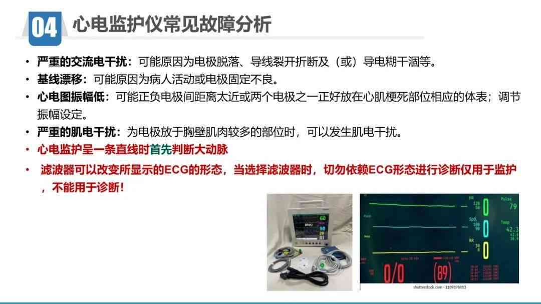 胎心监护仪ai报告是什么意思啊：解读胎心监护alarm含义与报告怎么看