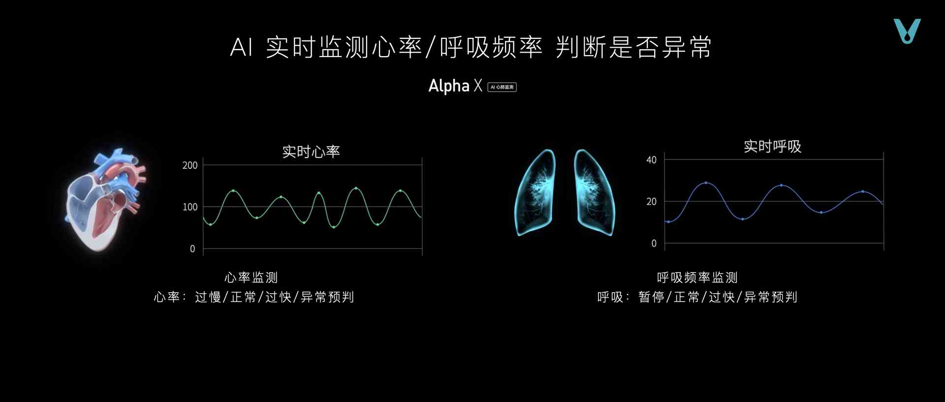心电智能ai报告