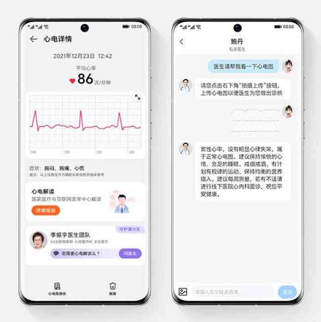 心电智能ai报告