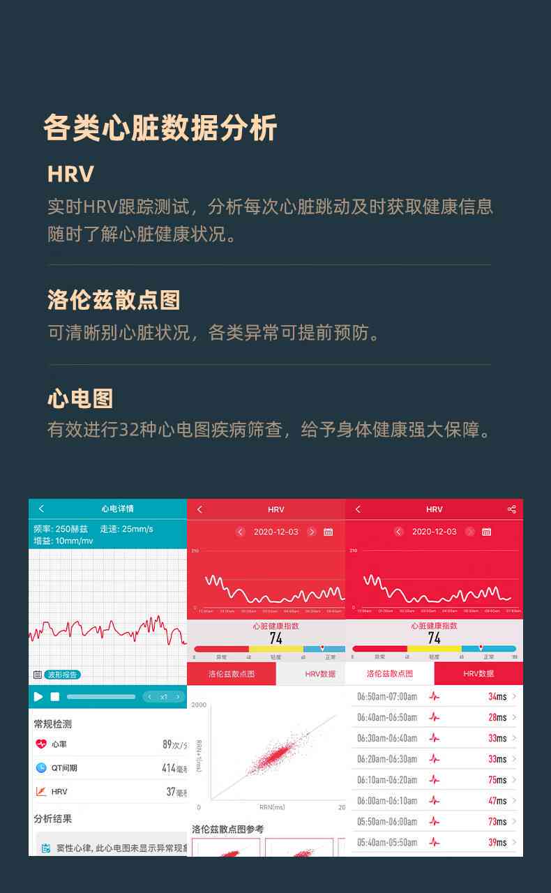 心电智能ai报告