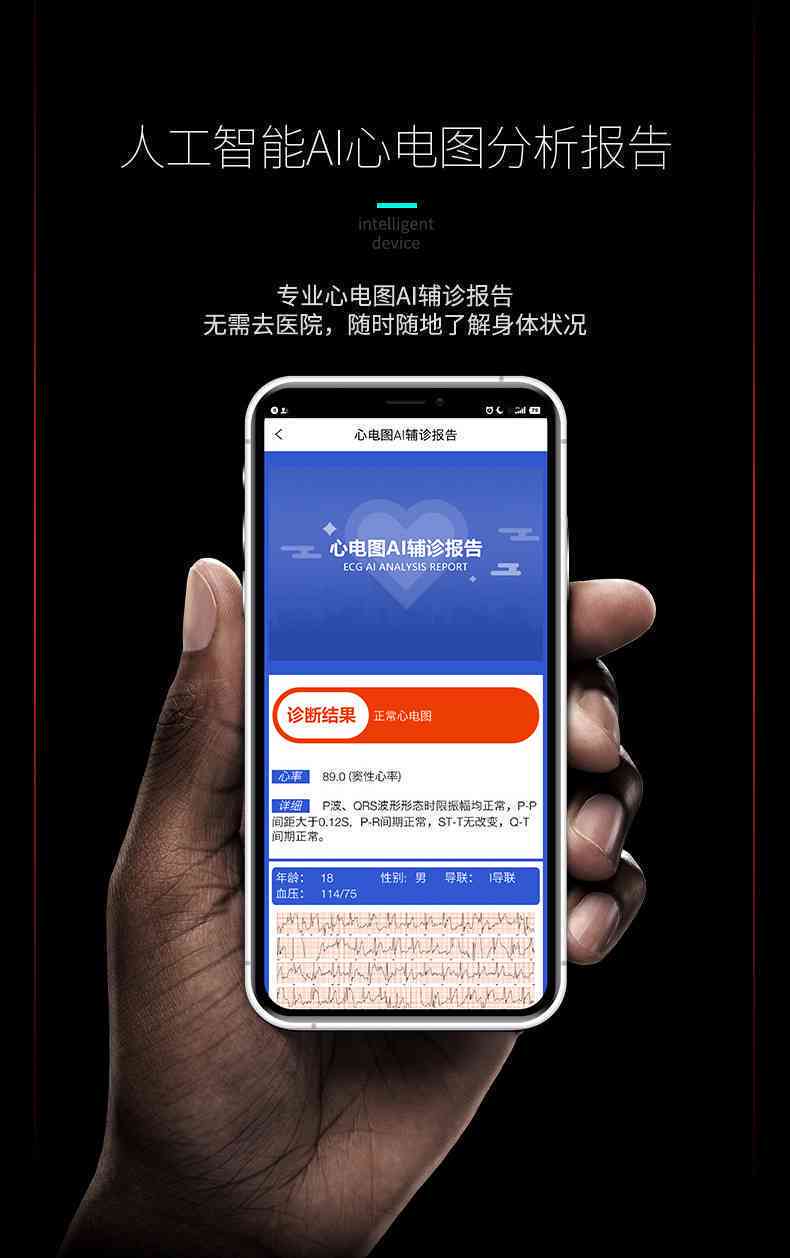 心电智能ai报告