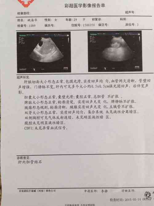 三维彩超ai生成脸文案-三维彩超照片发朋友圈的说说