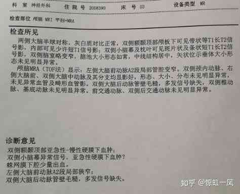 ai磁共振报告