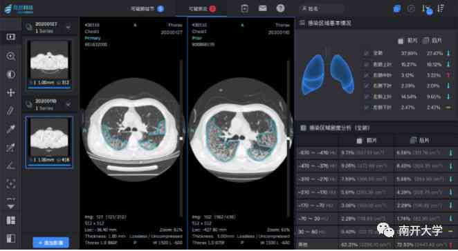 Ai血常规报告解读软件-ai血常规报告解读软件下载