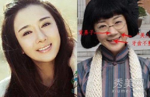 李依晓承认整容 私照曝光揭5次整容细节(图)