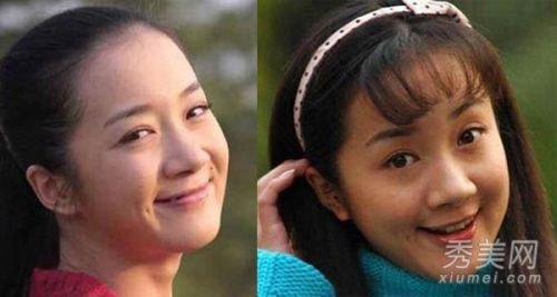 李依晓承认整容 私照曝光揭5次整容细节(图)