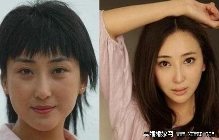 为她而战严屹宽老婆杜若溪个人资料 揭秘杜若溪整容上位史