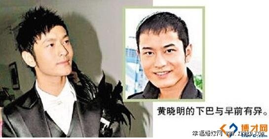 黄晓明血管爆破是怎么回事?整容后遗症都有哪些揭黄晓明个人资料及整容前后比