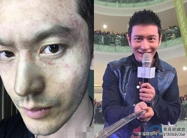 黄晓明血管爆破是怎么回事?整容后遗症都有哪些揭黄晓明个人资料及整容前后比