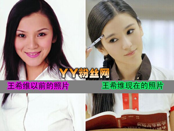 王希维整容前后照片