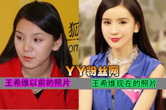 王希维整容前后照片
