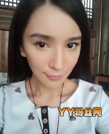 王希维整容前后照片