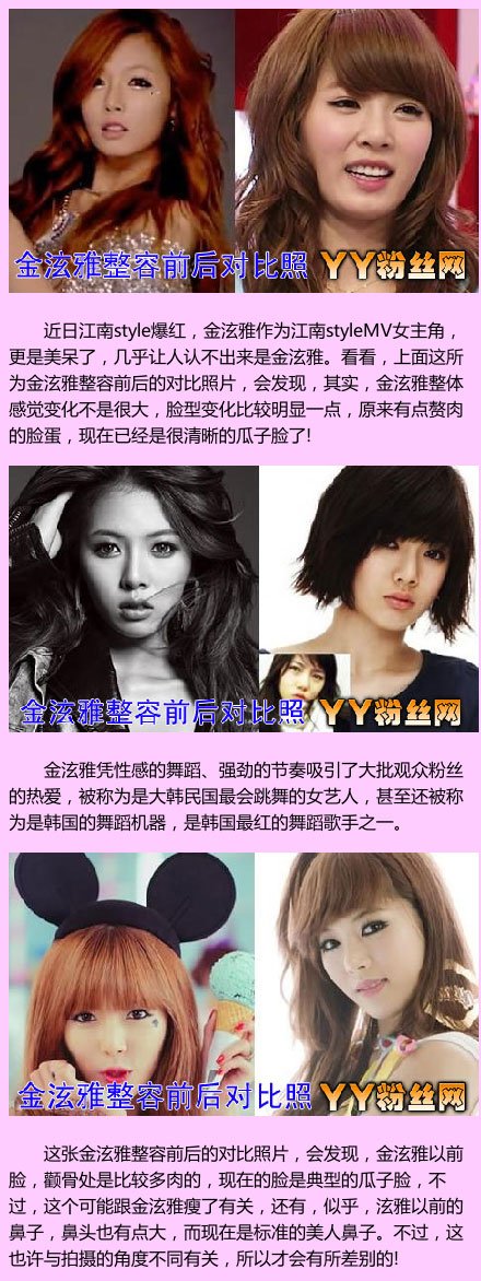 金泫雅整容前后照片对比