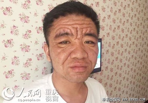 30岁像老头的袁太平得的是什么病?袁太平个人资料及成长经历引关注