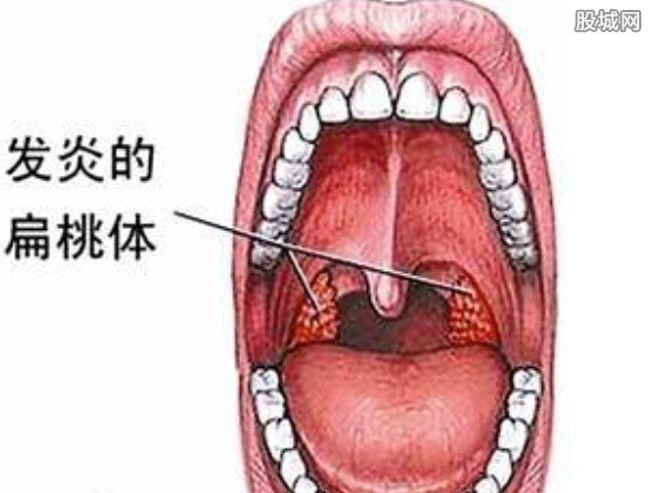 女子喉咙不适信偏方